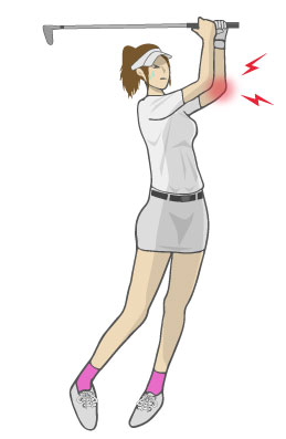 ゴルフ肘　女性