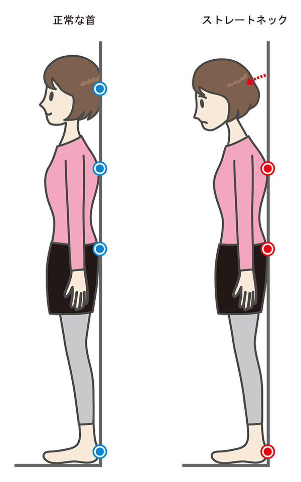 ストレートネックの見分け方のイラスト