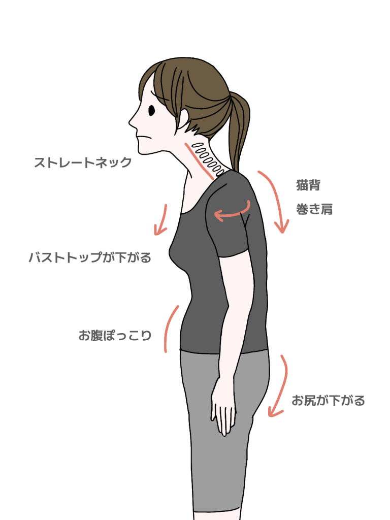 猫背巻き肩 女性