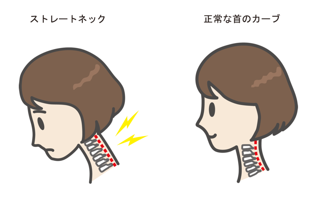 女性のストレートネック