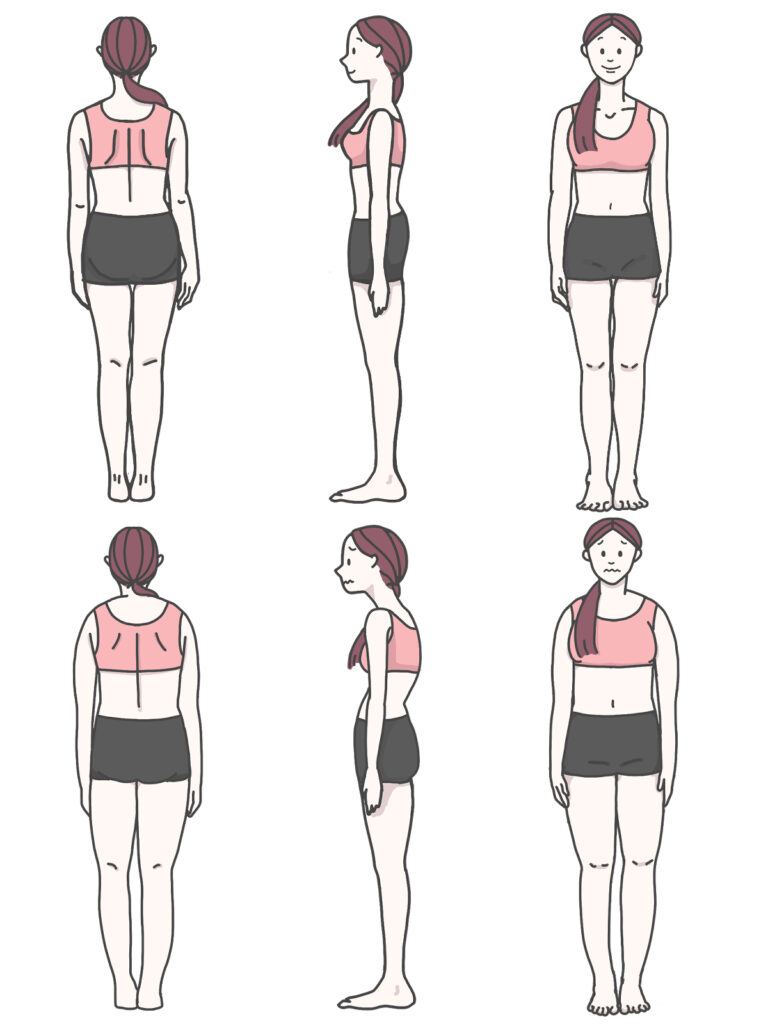 O脚の女性　比較