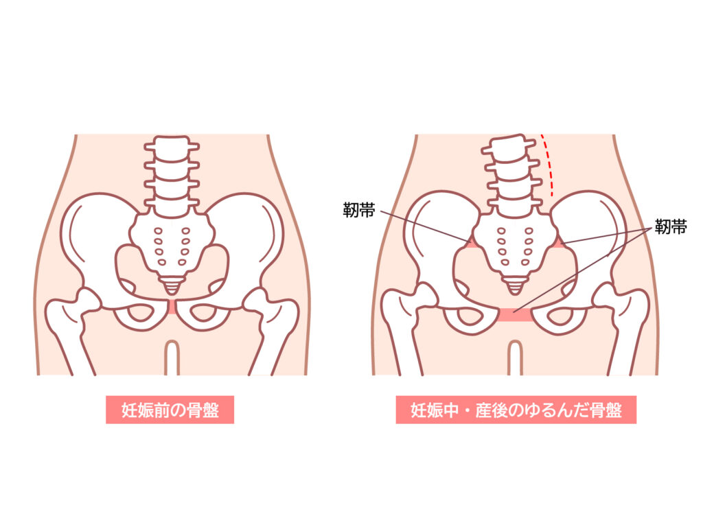 産後の骨盤の変化