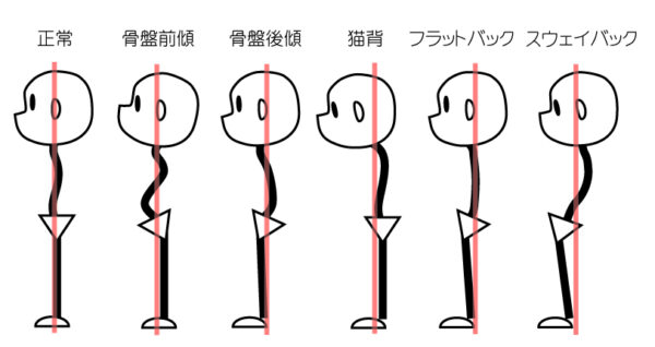 姿勢のタイプ